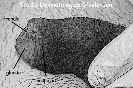 Il pene prima della circoncisione