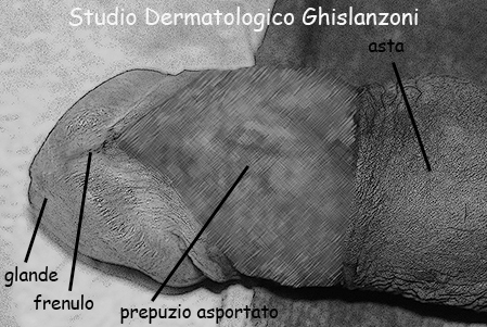 Circoncisione_2.jpg