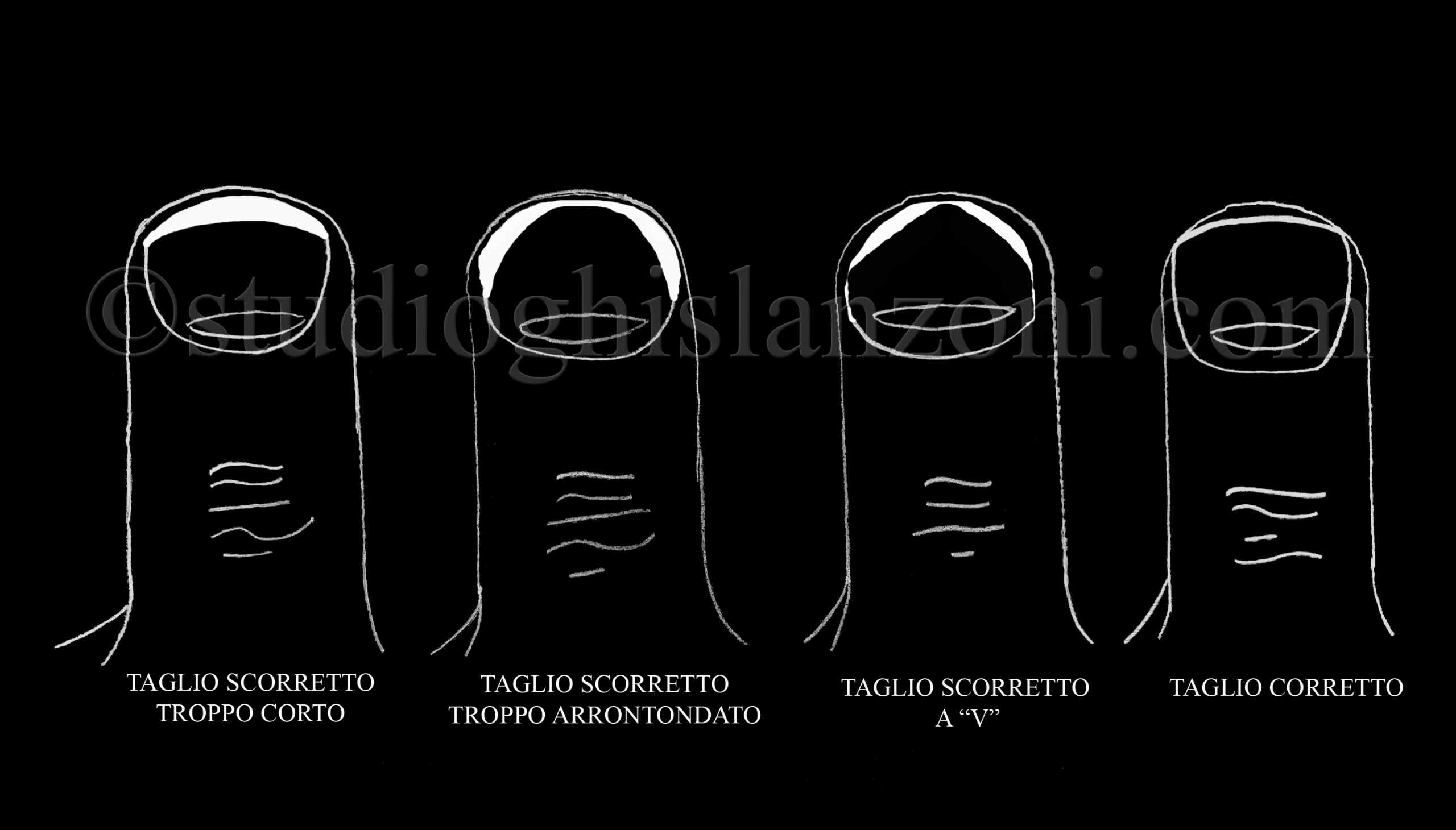 Come tagliare correttamente le unghie