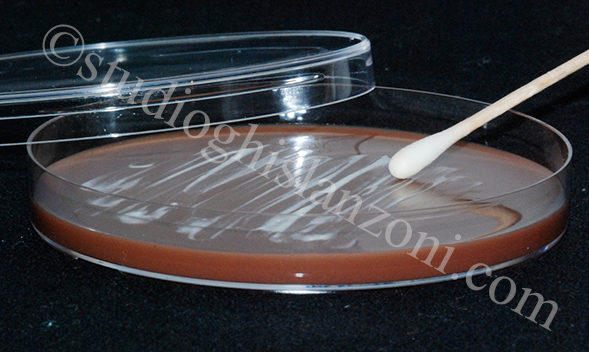 Esame-colturale-per-gonorrea.jpg
