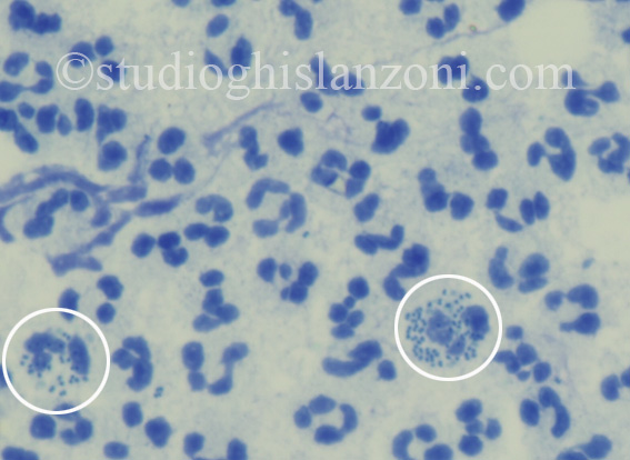 Gonococchi visualizzati al microscopio ottico
