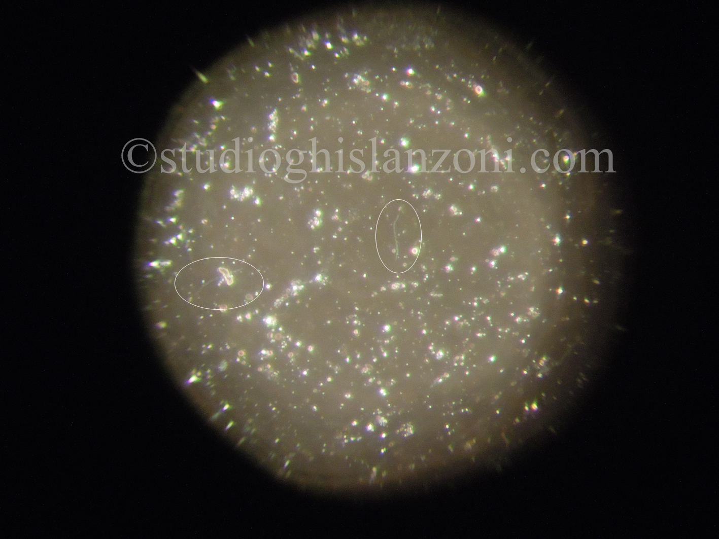 Treponema-pallidum-al-microscopio.jpg
