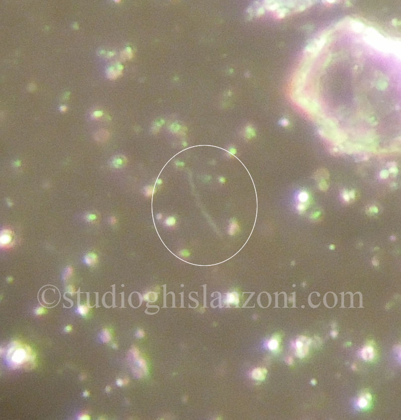 Treponema-pallidum.jpg