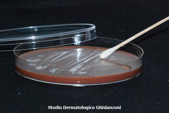 Malattie veneree: foto esame colturale