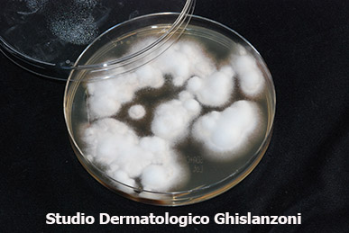 Malattie veneree: foto esame micologico2