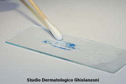 Malattie veneree: foto Esame microscopico
