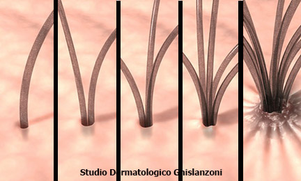 follicolo pilifero