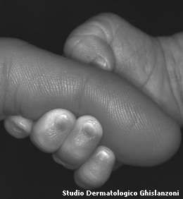 unghie in età pediatrica