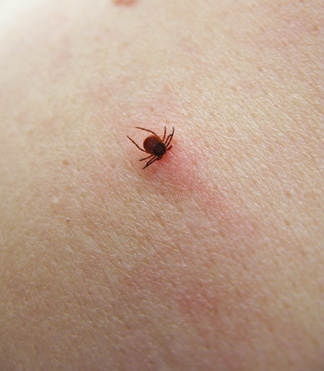 puntura zecca