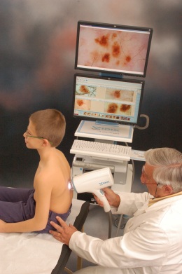 videodermatoscopio per mappatura nei