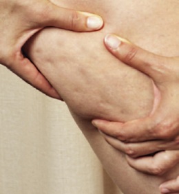 mesoterapia