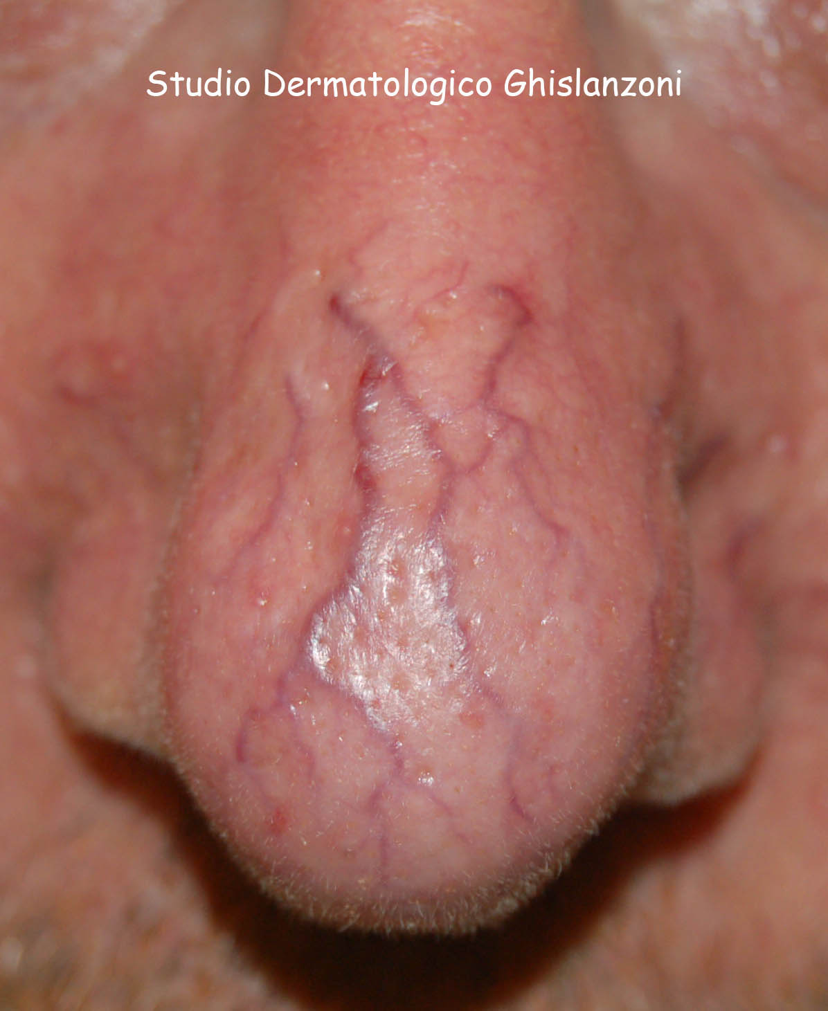 Capillari